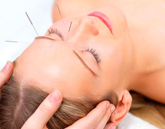 acupuntura facial cancun