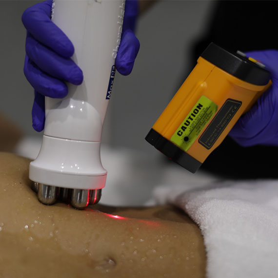 Radio Frequency – Skin Tightening Cancun